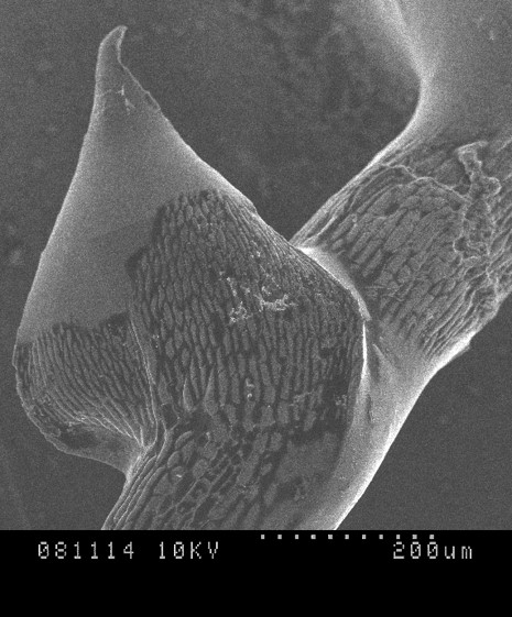 microbes